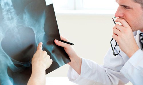 Osteoarthritis a térdízület (gonartrózis) kezelés 1, 2, 3 fok