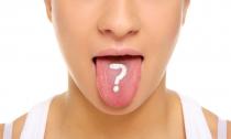 Kaj pomeni slab zadah in bela obloga na jeziku?